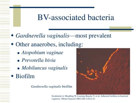 ppt the complexity of bacterial vaginosis powerpoint presentation