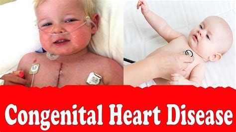 congenital heart disease types   symptoms