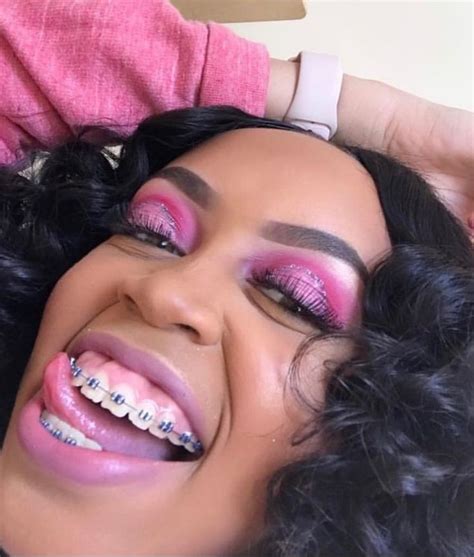 pin by iitsnalaa 🧞‍♀️ on bracefacee cute braces cute