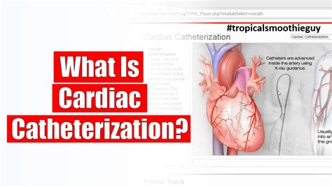 what is cardiac catheterization