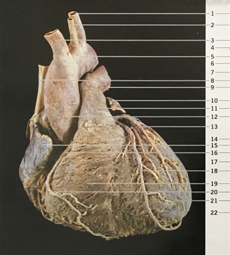 anterior view  heart cadaver diagram quizlet