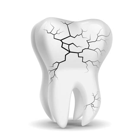 odontology student treatment planning  single tooth restoration