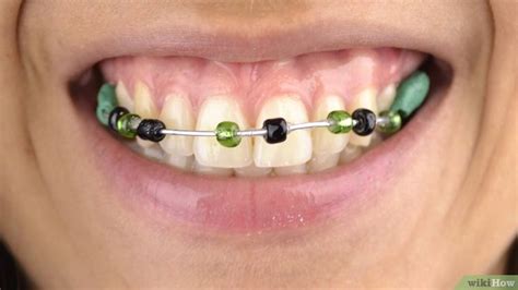 How To Make Fake Braces 11 Steps With Pictures Fake Braces Diy
