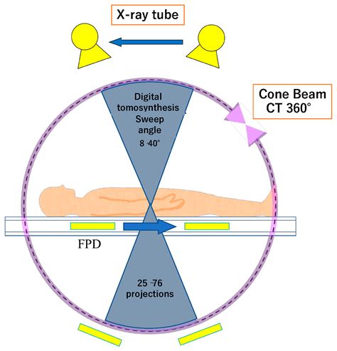 diagnostics  full text advances  bone joint imaging metal