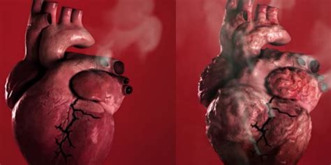 this scary video shows how smoking leads to heart disease
