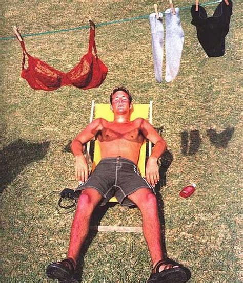 Bad Sunburn That Dude Picked The Wrong Place To Sun Tan His Body
