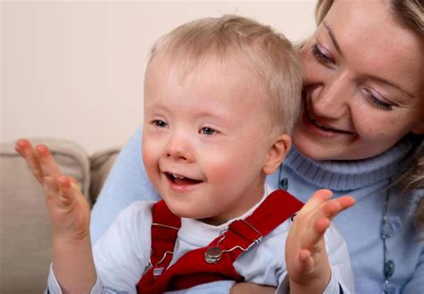 What Are The Different Types Of Down Syndrome Treatment