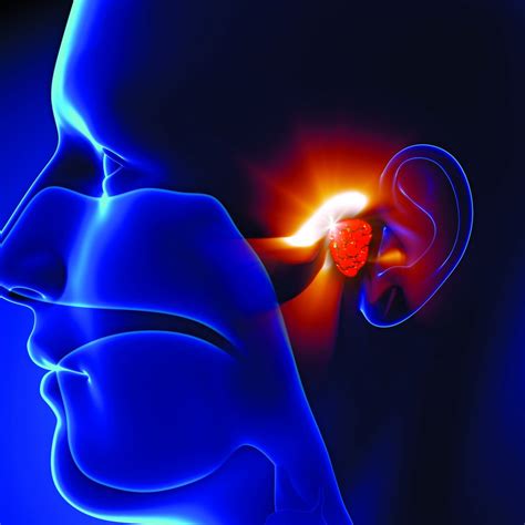 hearing loss poland   case reports symptoms treatment