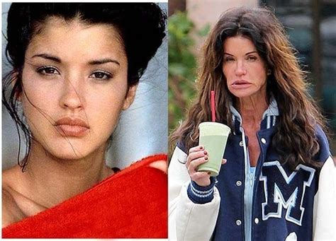 22 Most Shocking Celebrity Before And After Plastic