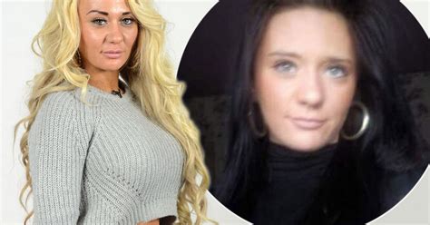 josie cunningham pictured before surgery amid claims bullying made her