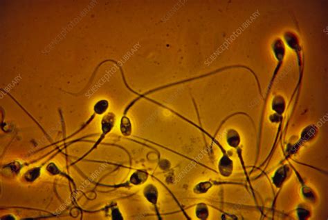 lm of normal human sperm stock image p624 0016 science photo library