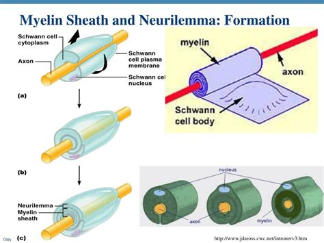 myelin sheath destruction inherited  acquired disorders  myelin  underlying myelin