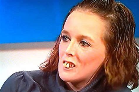 Jeremy Kyle Guest Given Teeth Transformation Daily Star