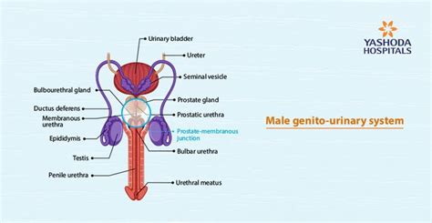 Male Urethral Stricture The Disease Is As Old As