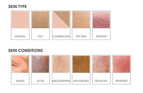skin types conditions leaderma
