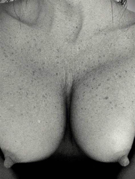 Freckled Chest Porn Pic Eporner