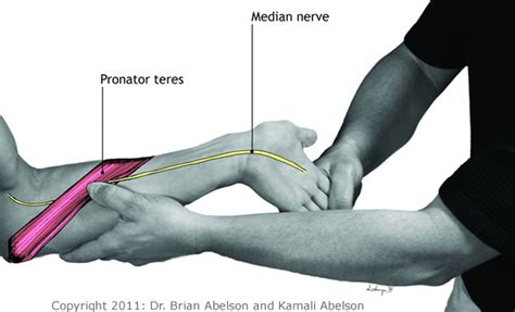 Pronator Teres And Median Nerve Entrapment Syndromes
