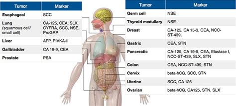 Rosh Review Tumor Medical Facts Internal Medicine