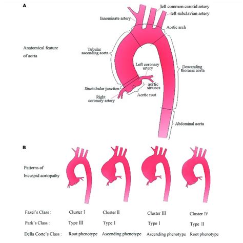 The Sievers Classification Of The Bav The Bicuspid Valve Is Classified