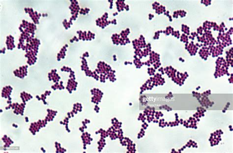 Staphylococcus Aureus Gram Positive Spherical Bacteria
