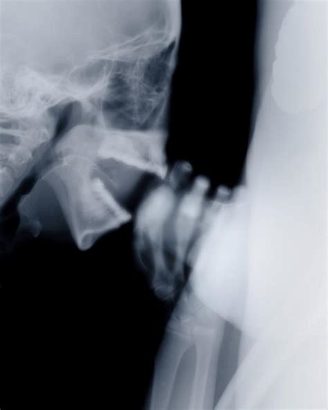 x ray see through sex