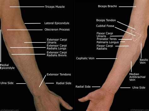 forearm pain relief   treatment deep recovery