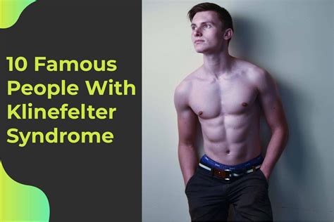 What Is Klinefelter Syndrome Klinefelter Syndrome Syndrome Images And