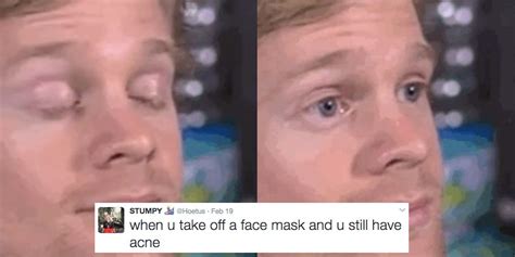 17 Tweets That Prove That  Of A Dude Blinking Is The