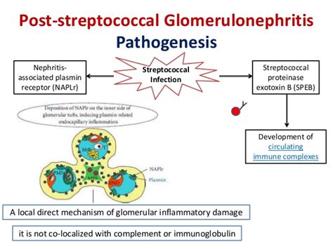 Infection Related Glomerulopathy Introduction Rapid