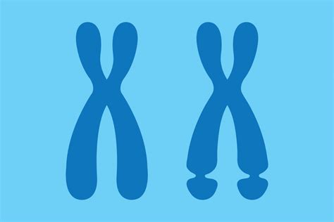 New Explanation Offered For Symptoms Of Fragile X Syndrome – Washington