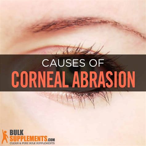 Corneal Abrasion Symptoms Causes And Treatment