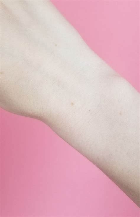 viral wrist freckle challenge has people sharing photos of matching