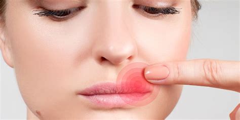 what causes cold sores how to treat and prevent cold sores