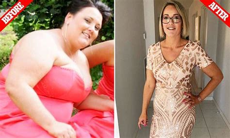 morbidly obese woman sheds half her body weight obese women body