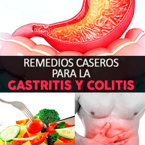 14 remedios caseros para la gastritis y colitis la guía de las vitaminas