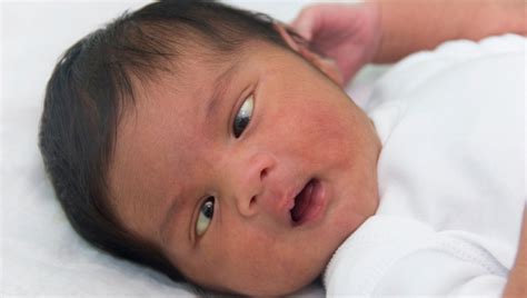 waarom pasgeborene scheel kijken kinderfysioblog anne pauw