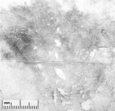 Fbi — Figure 11 Palm Print Recorded Without Using The Boiling Technique