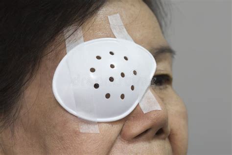 eye shield covering  cataract surgery stock image image