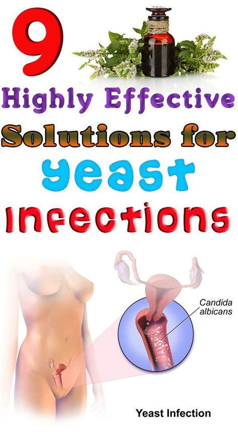 9 highly effective solutions for yeast infections recurring yeast