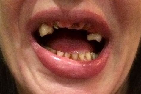 mum whose teeth were ripped out with pliers by rapist releases picture