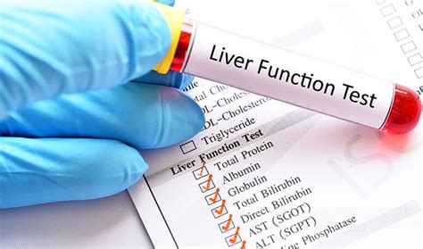 liver function test lft test   price  delhi ncr hadlabs