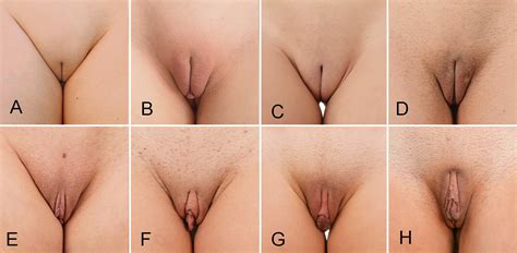 poll labia minora from hidden to large take your pick