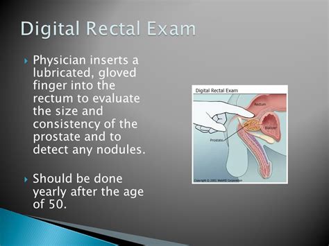 Recovery Time After Rectal Prolapse Surgery Rectal Prolapse And