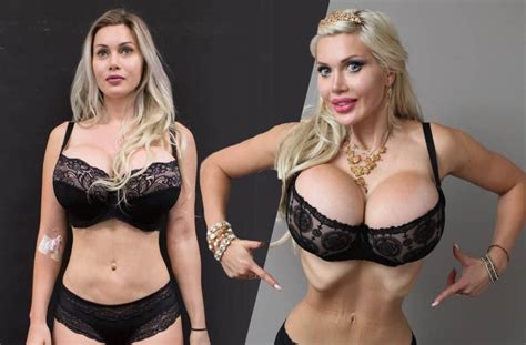 surgery loving model spends over 120k to look like a cartoon character with 14 waist
