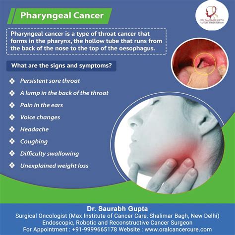 dr saurabh gupta oncologist signs symptoms  pharyngeal cancer