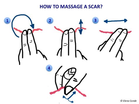 How To Massage A Scar Elena Conde Montero