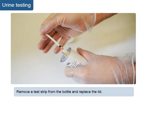 urine testing rcn