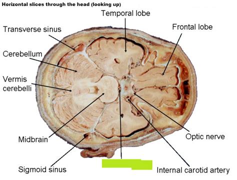 level  neuroanatomy cns morphology  nervous system oxford memrise
