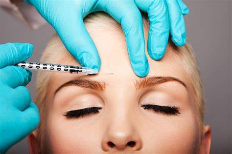 botox injection  forehead stock  pictures royalty