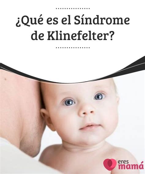 ¿qué es el síndrome de klinefelter con imágenes salud infantil